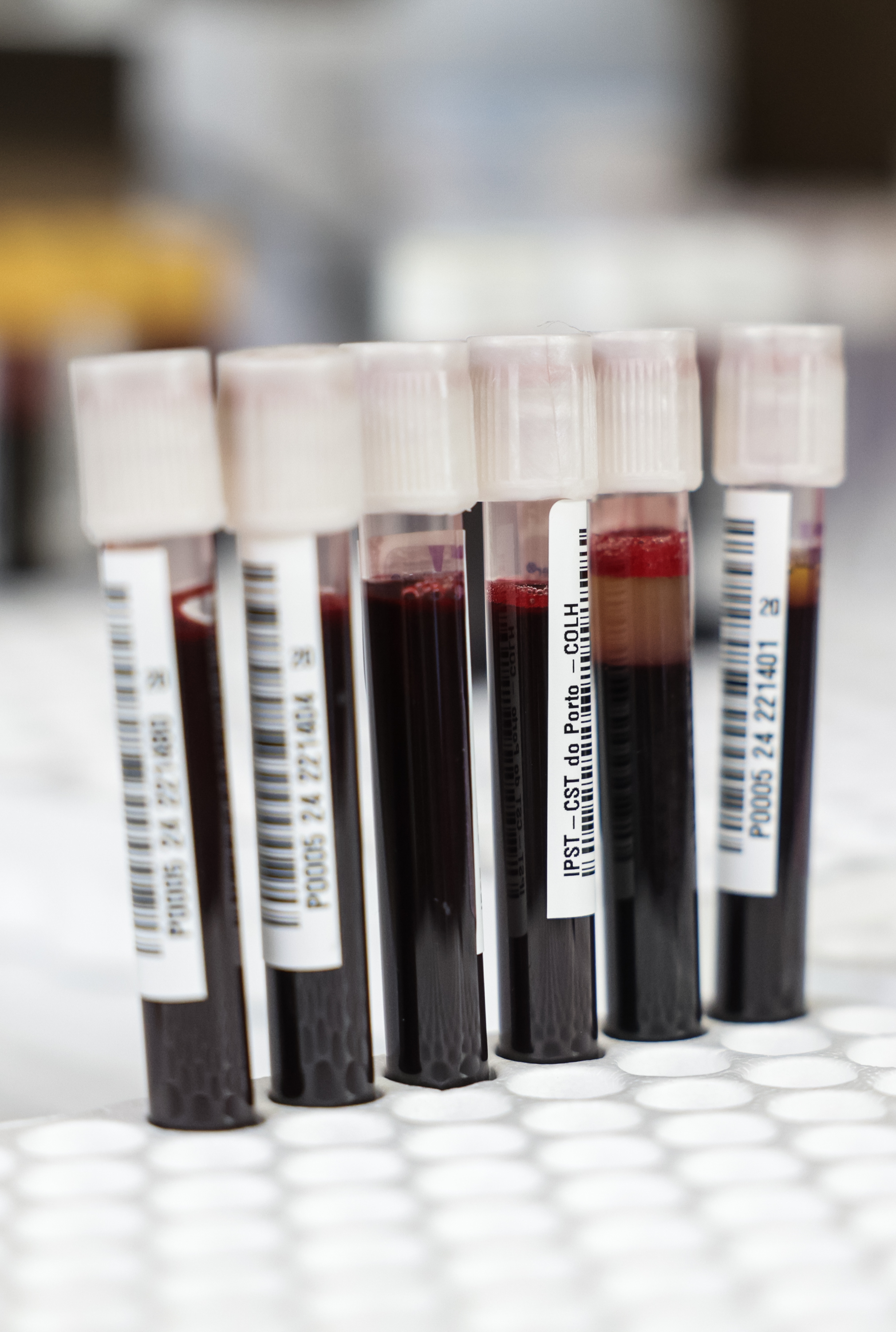Imagem número 2 da galeria Dádiva de Sangue